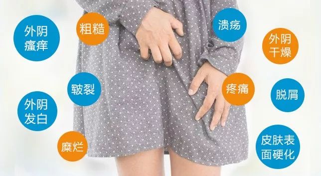 患上外阴白斑后的危害有哪些?